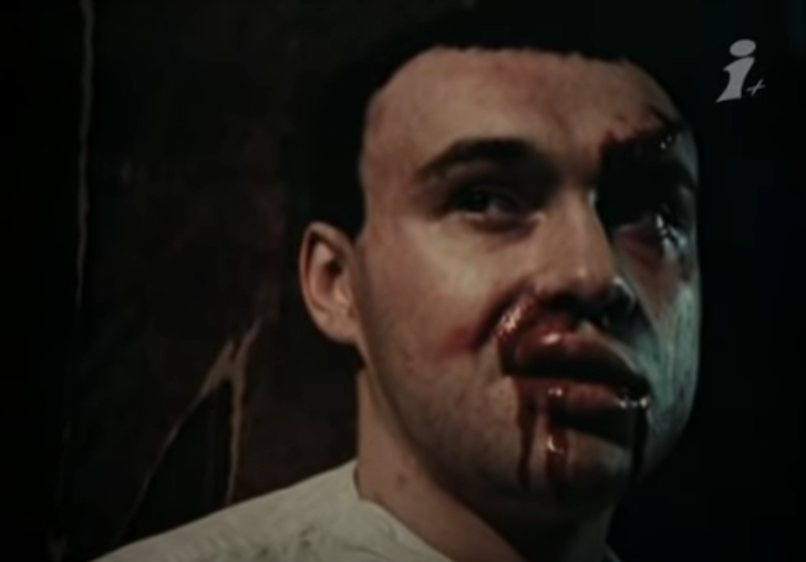 Кисневий голод